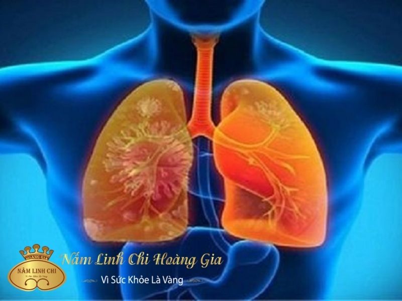 tc3a1c20he1baa1i20ce1bba7a20vaseline202 tac-hai-cua-vaseline